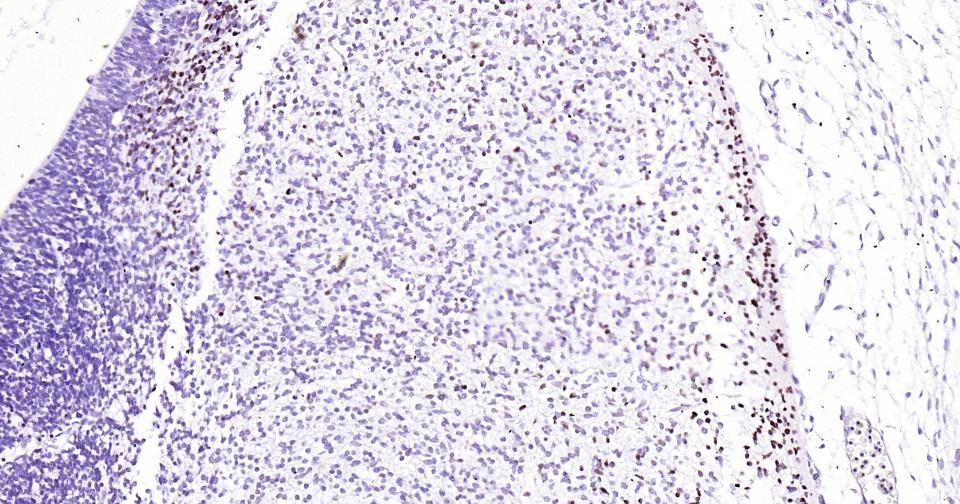 TBR1蛋白重组兔单抗
