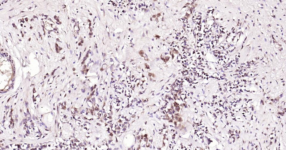 微管蛋白β1 tubulin(内参)单克隆抗体-bsm-33041M