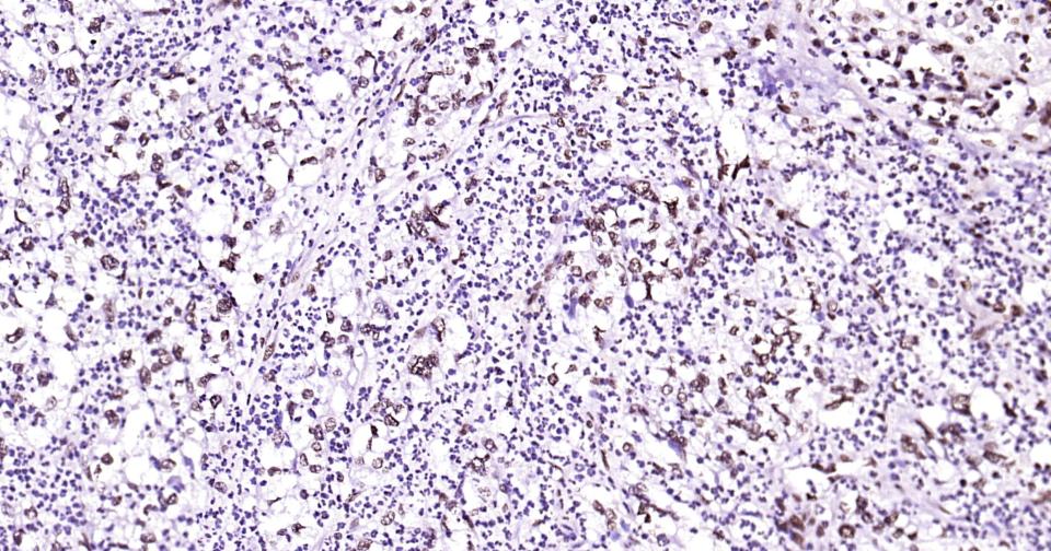 发状分裂相关增强子-5重组兔单抗