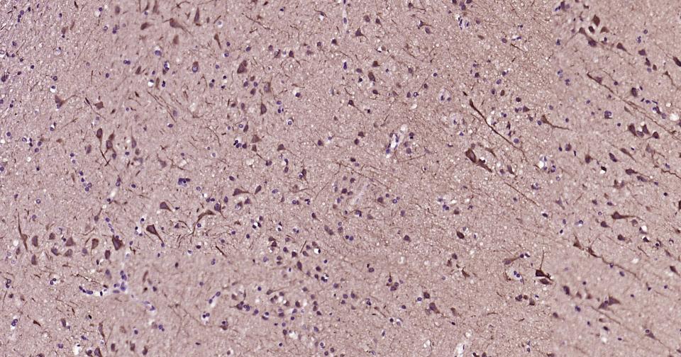 高分子量神经丝蛋白抗体