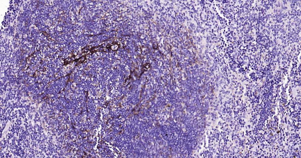 神经生长因子受体重组兔单抗-bsm-52253R