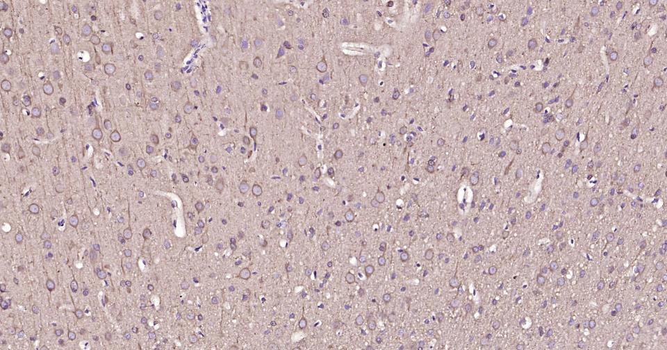 微管蛋白β1 tubulin(内参)单克隆抗体-bsm-33041M