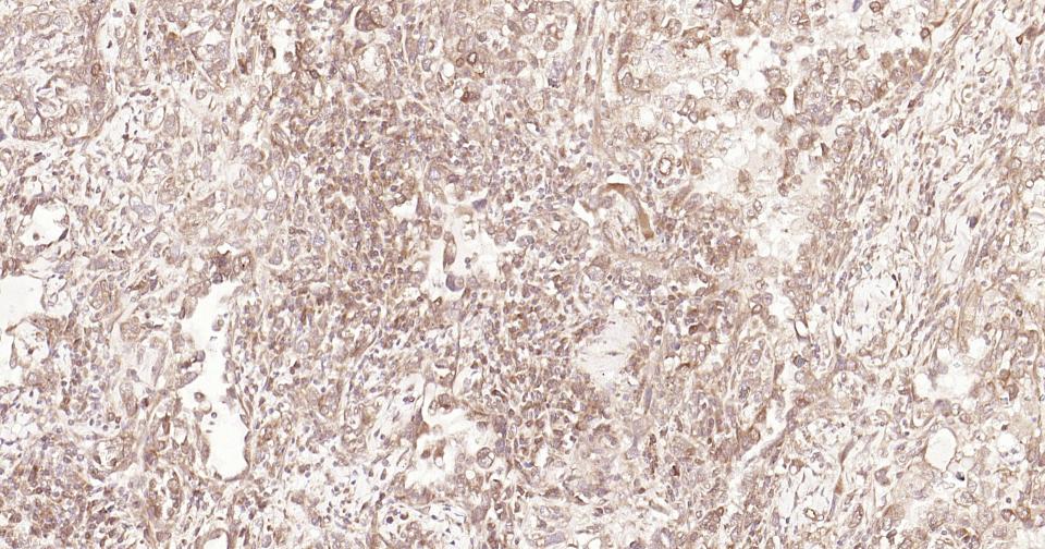 信号转导和转录激活因子3重组兔单抗