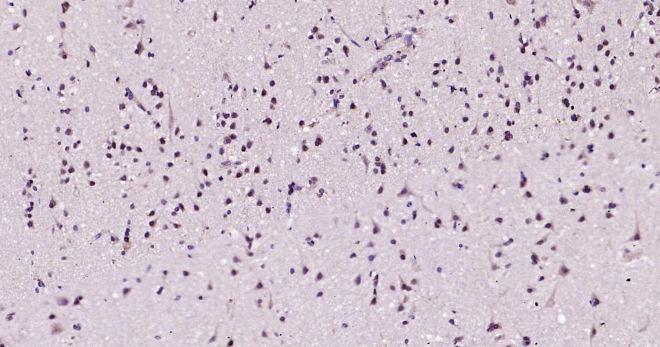 TBR1蛋白重组兔单抗
