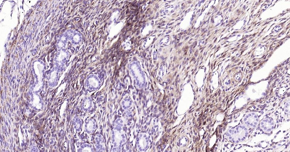 神经生长因子受体重组兔单抗-bsm-52253R