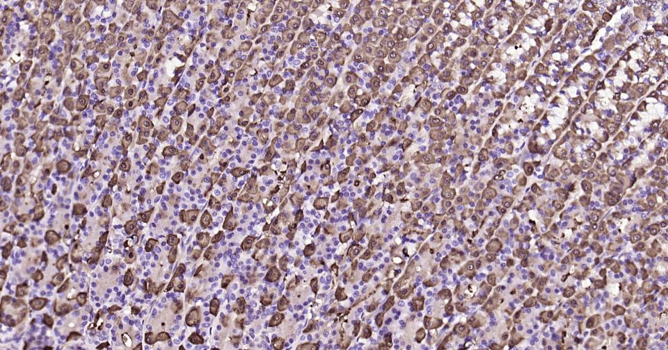 核因子κB抑制蛋白α重组兔单抗