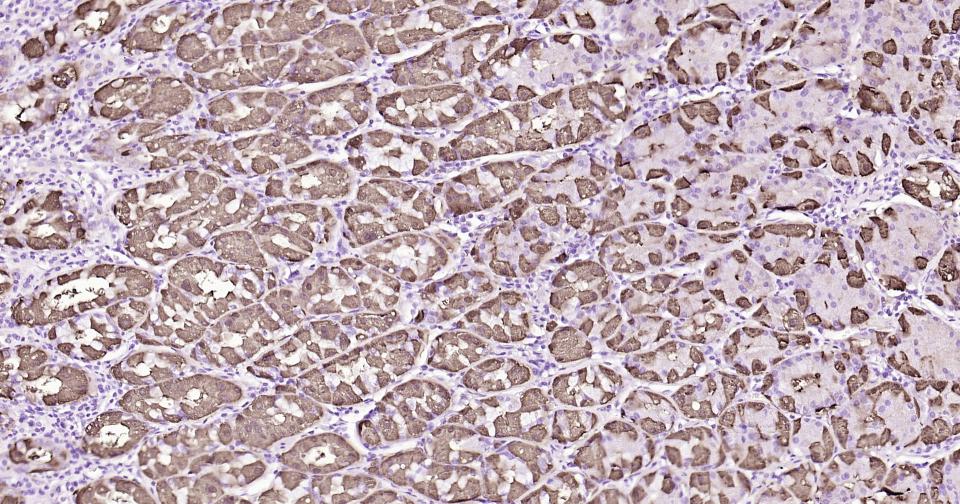 核因子κB抑制蛋白α重组兔单抗