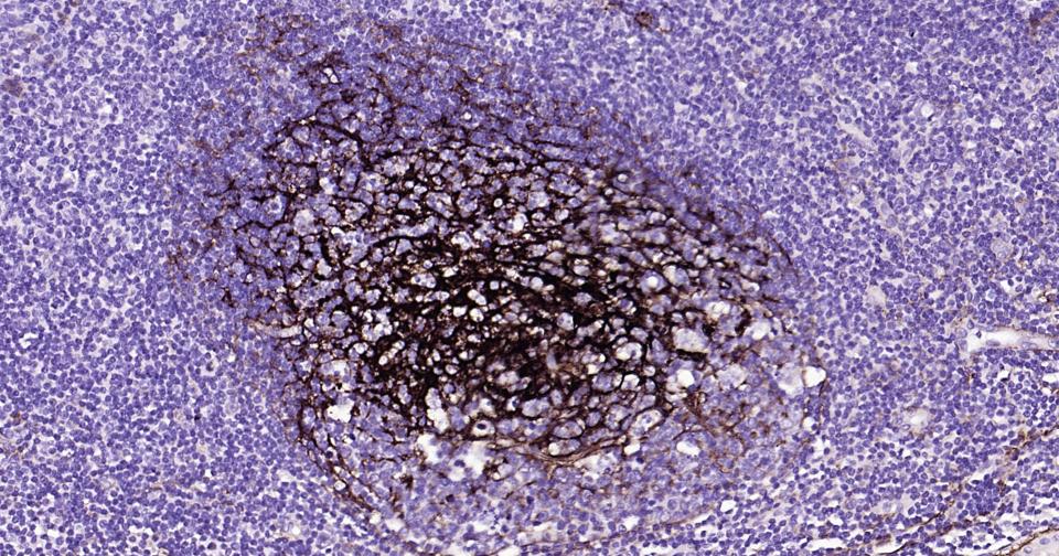 NGFR/p75NTR Recombinant Rabbit mAb (一抗) - IHC-P,IHC-F,IF,ICC/IF | Bioss