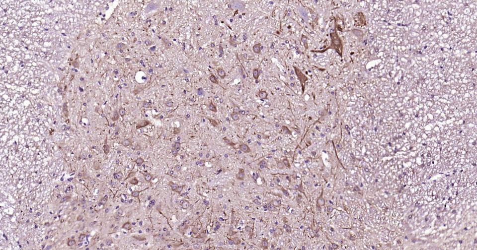 高分子量神经丝蛋白抗体