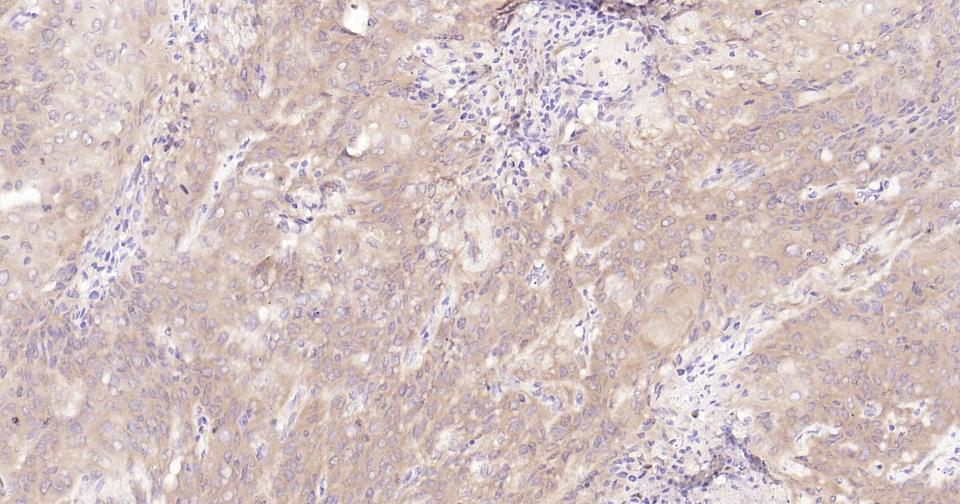 信号转导和转录激活因子3重组兔单抗