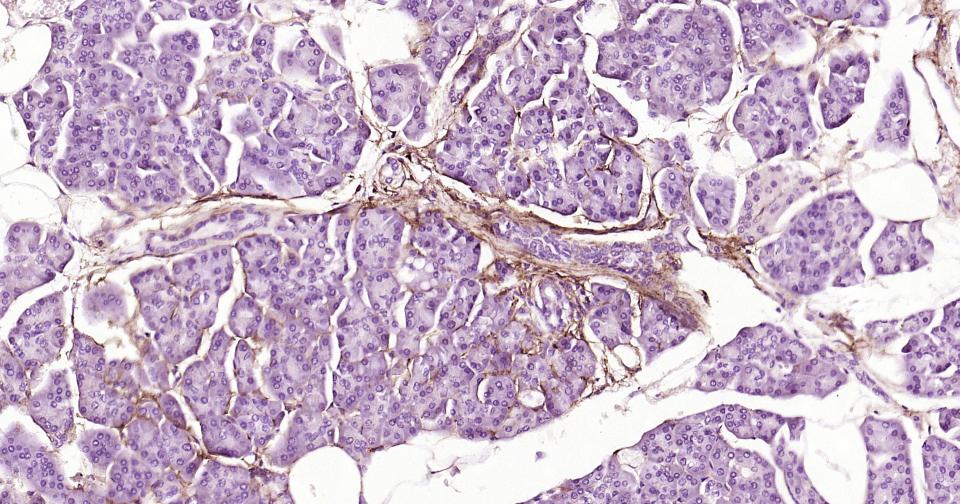 神经生长因子受体重组兔单抗-bsm-52253R