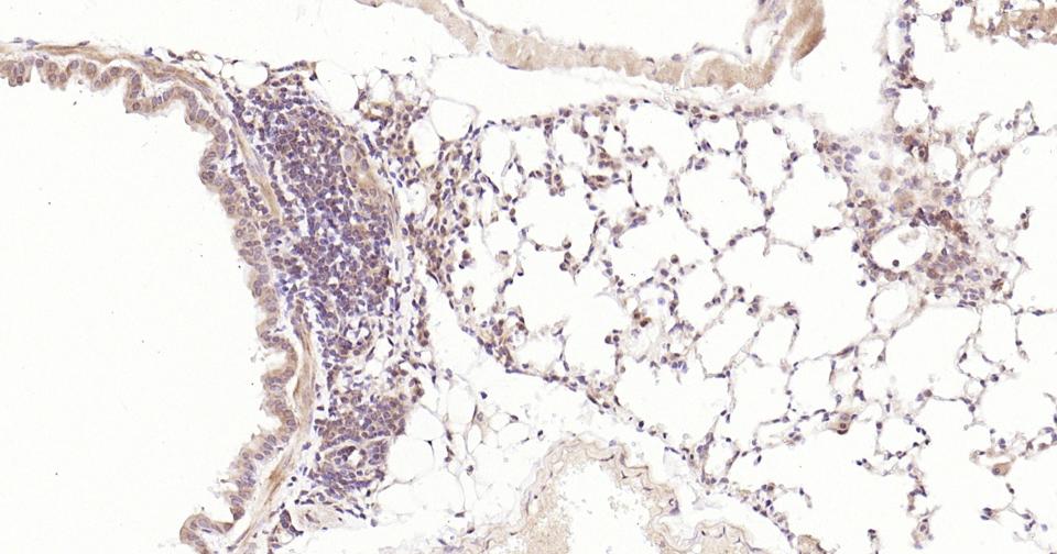 信号转导和转录激活因子3重组兔单抗