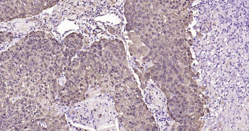 钙结合蛋白重组兔单抗