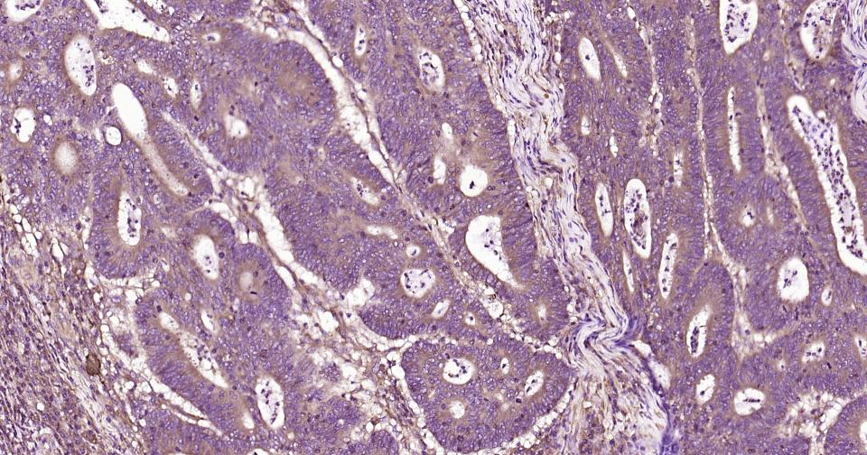 钙结合蛋白重组兔单抗