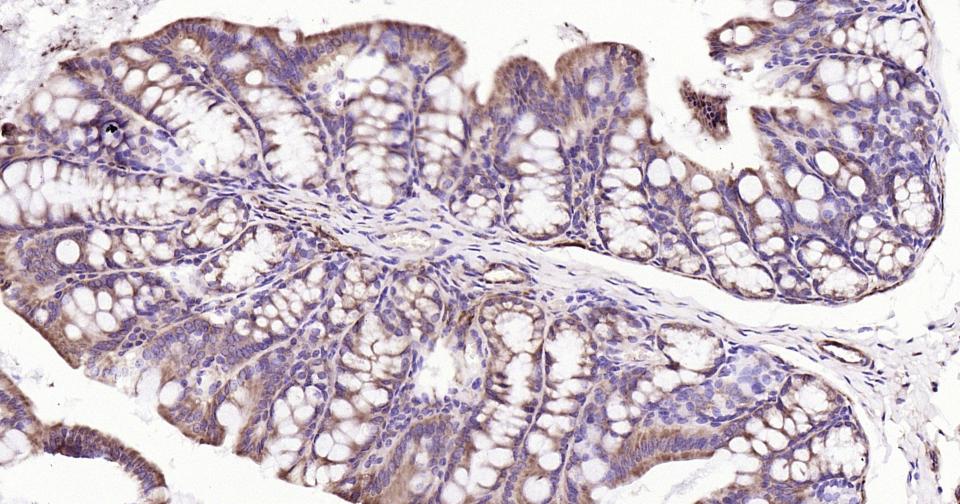 核因子κB抑制蛋白α重组兔单抗