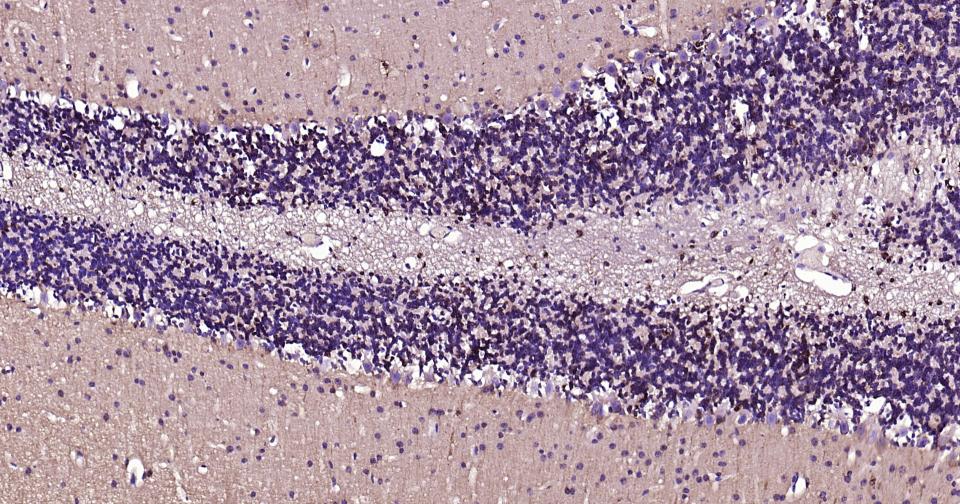 微管蛋白β1 tubulin(内参)单克隆抗体-bsm-33041M