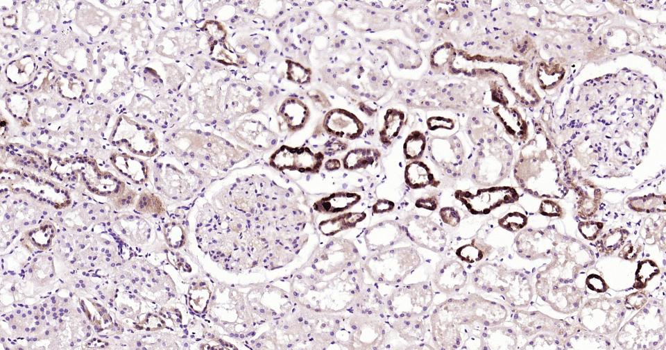 核因子κB抑制蛋白α重组兔单抗