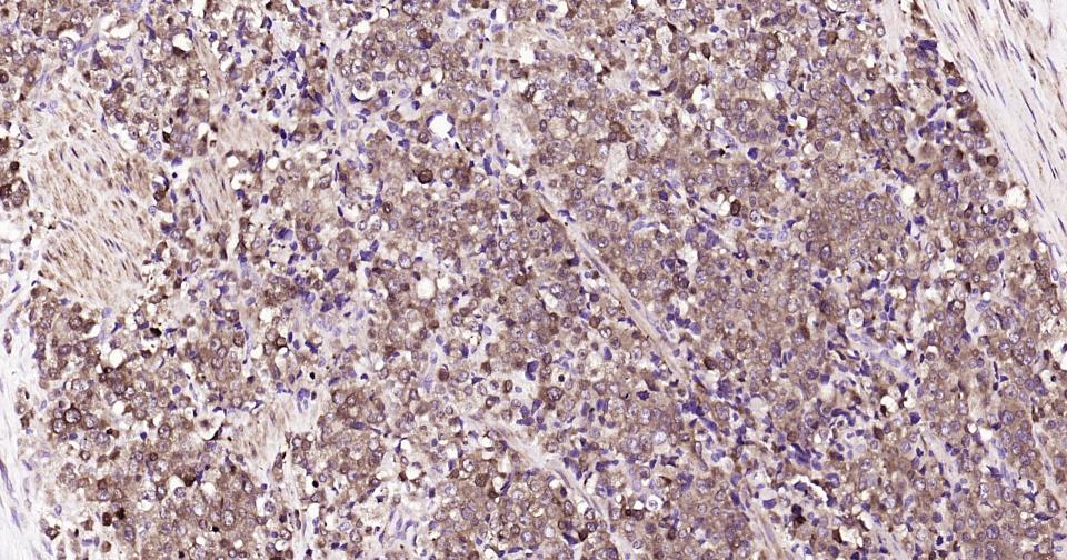 核因子κB抑制蛋白α重组兔单抗