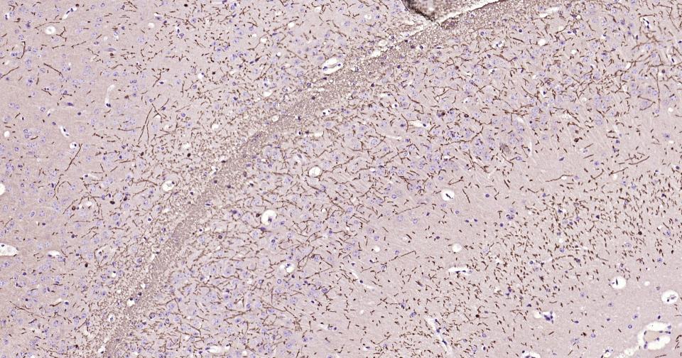 髓鞘碱性蛋白/磷脂碱性蛋白重组兔单抗