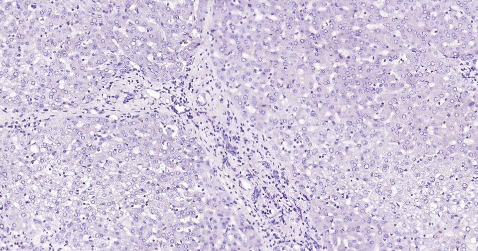钙结合蛋白D28K重组兔单抗