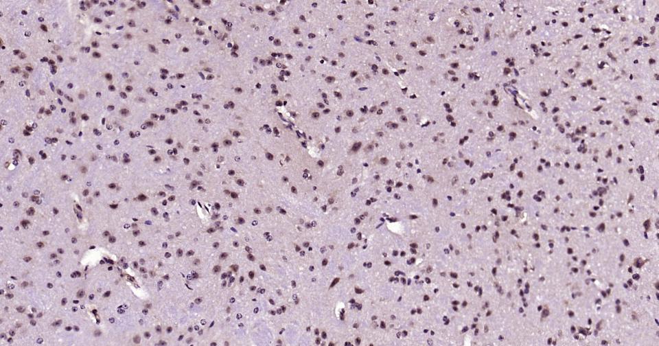 发状分裂相关增强子-5重组兔单抗