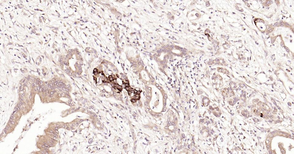 信号转导和转录激活因子3重组兔单抗