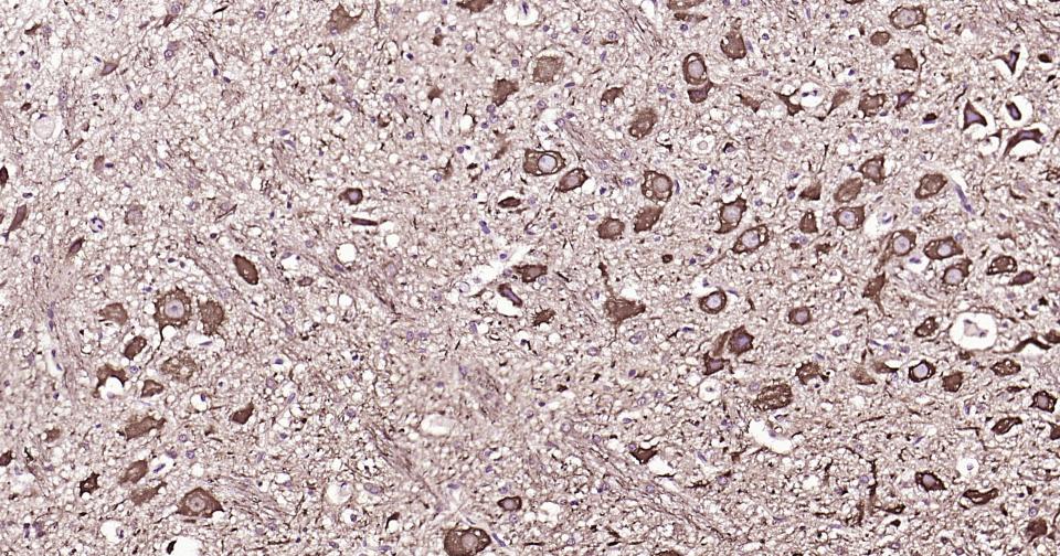 高分子量神经丝蛋白抗体