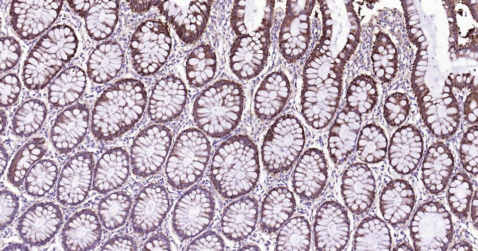 核因子κB抑制蛋白α重组兔单抗