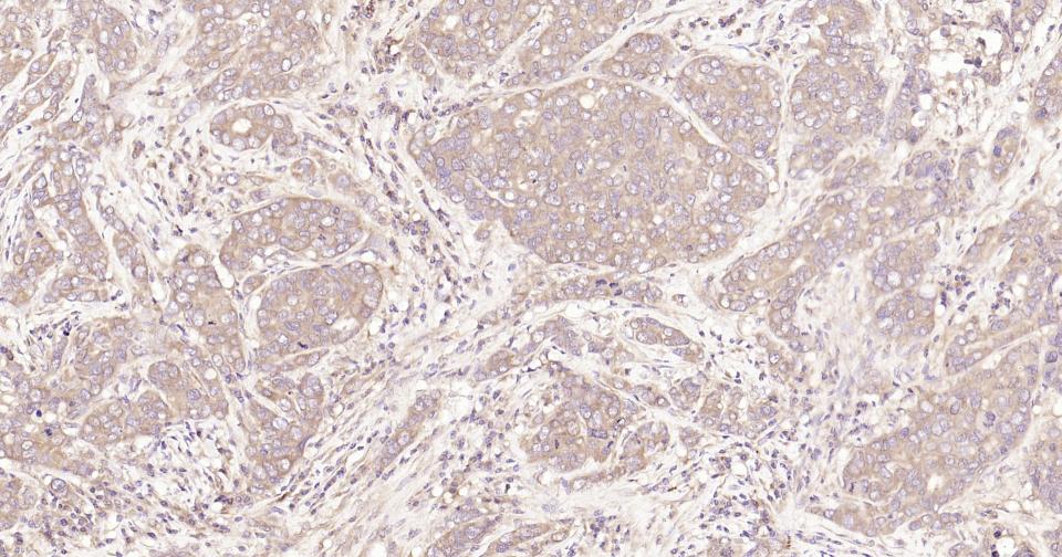 信号转导和转录激活因子3重组兔单抗