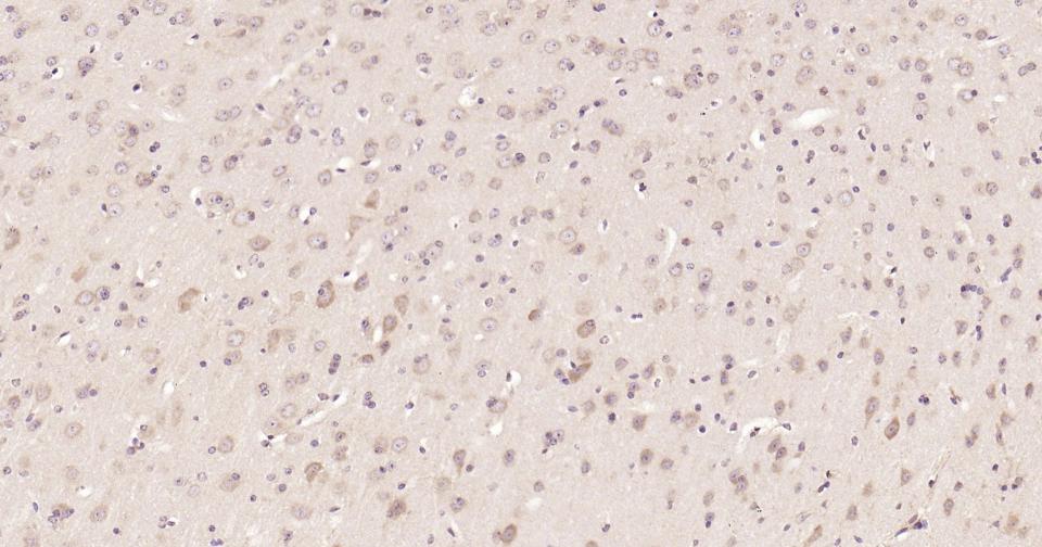 信号转导和转录激活因子3重组兔单抗