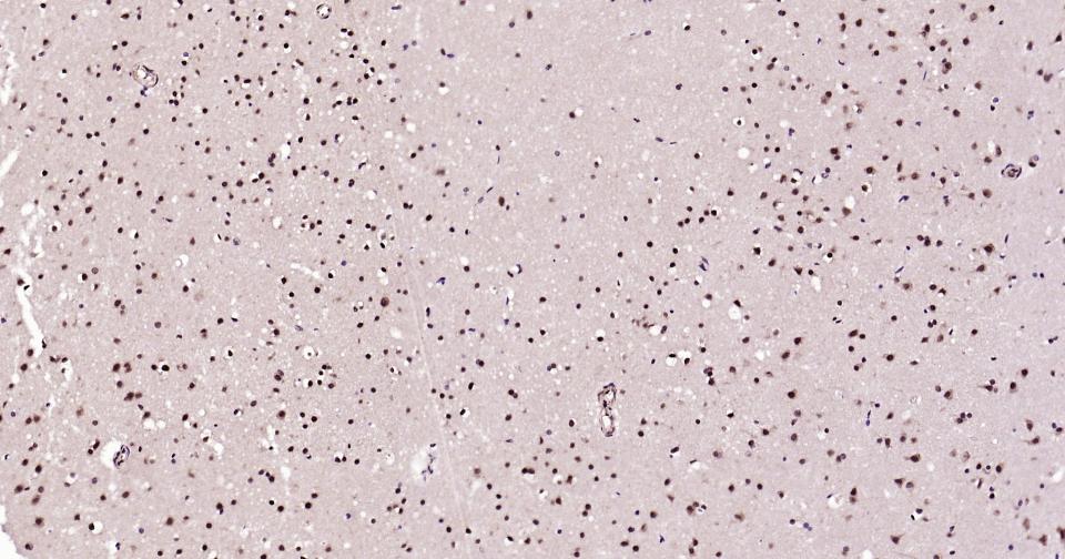 发状分裂相关增强子-5重组兔单抗