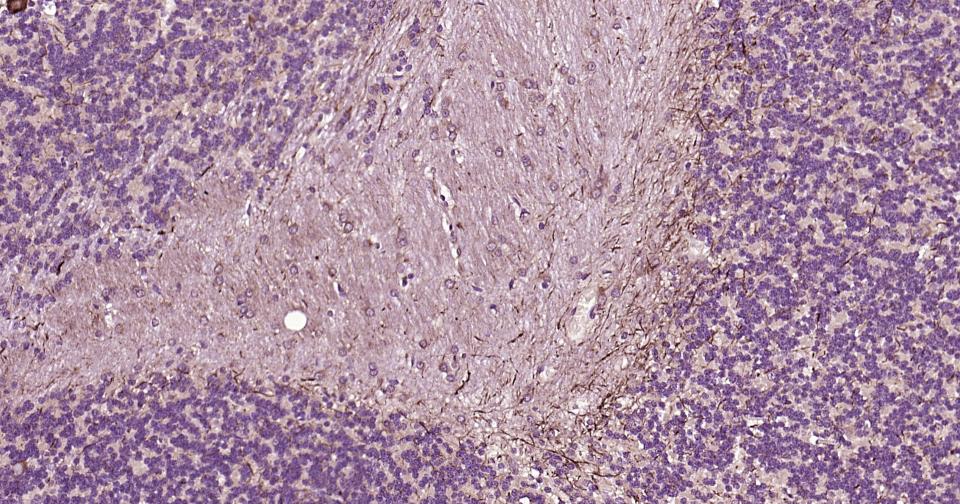 高分子量神经丝蛋白抗体
