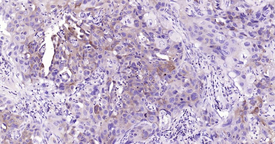 核因子κB抑制蛋白α重组兔单抗