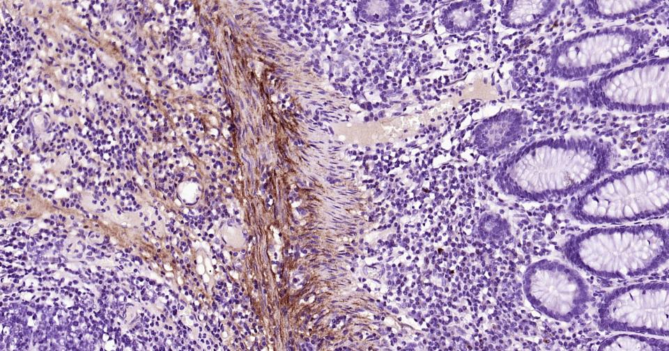 细胞粘合素(固生蛋白)重组兔单抗