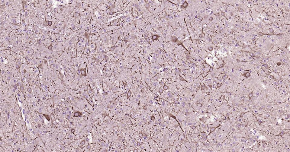 高分子量神经丝蛋白抗体