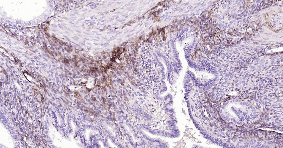 神经生长因子受体重组兔单抗-bsm-52253R