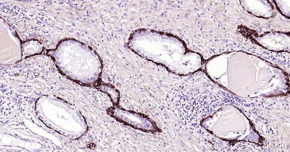 神经生长因子受体重组兔单抗-bsm-52253R