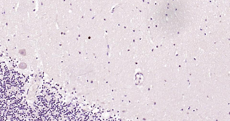 发状分裂相关增强子-5重组兔单抗