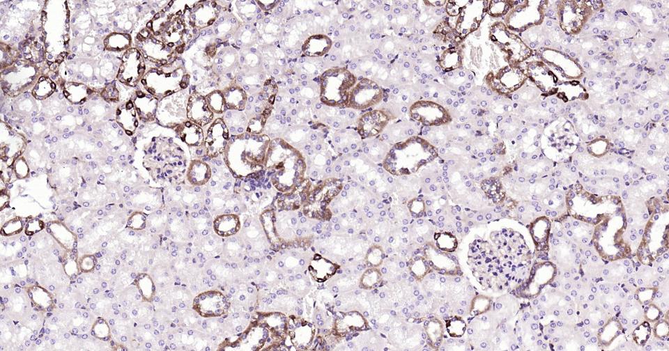 核因子κB抑制蛋白α重组兔单抗