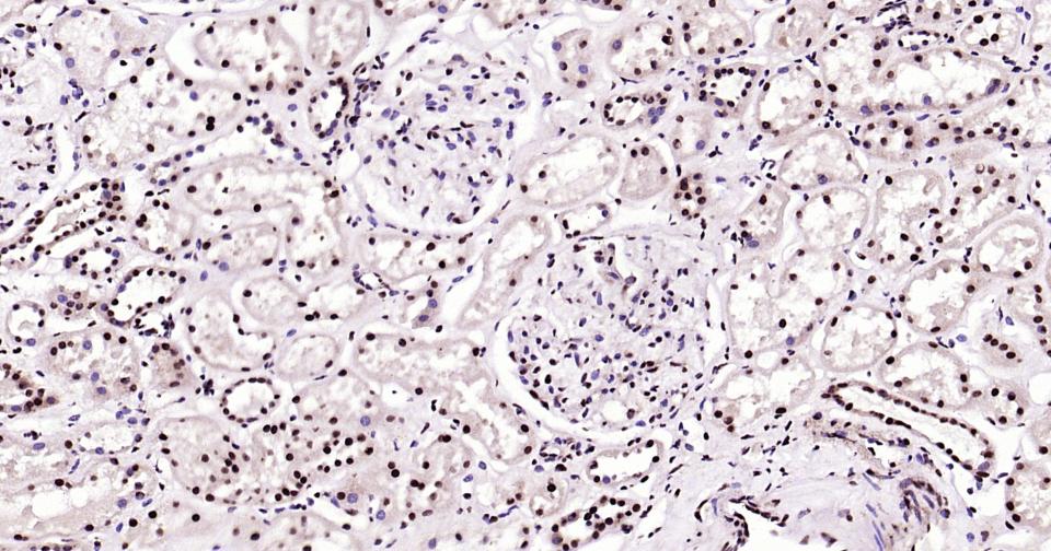 发状分裂相关增强子-5重组兔单抗