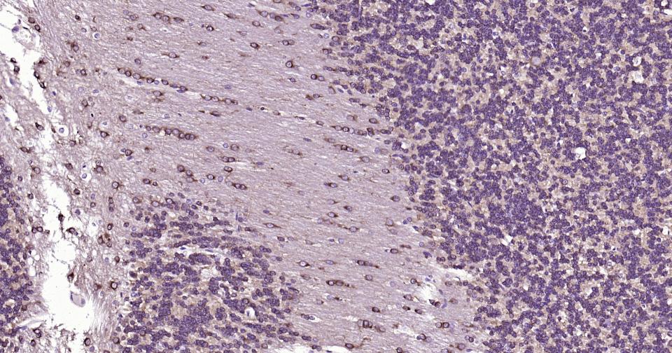 微管蛋白β1 tubulin(内参)单克隆抗体-bsm-33041M