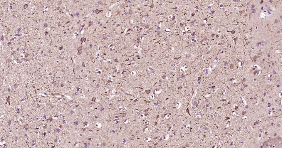 高分子量神经丝蛋白抗体