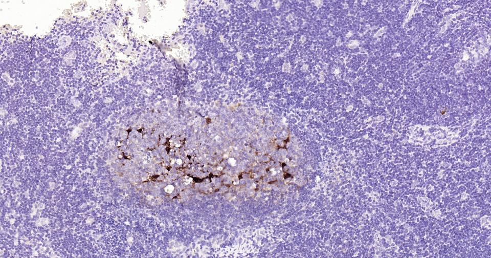 钙结合蛋白D28K重组兔单抗