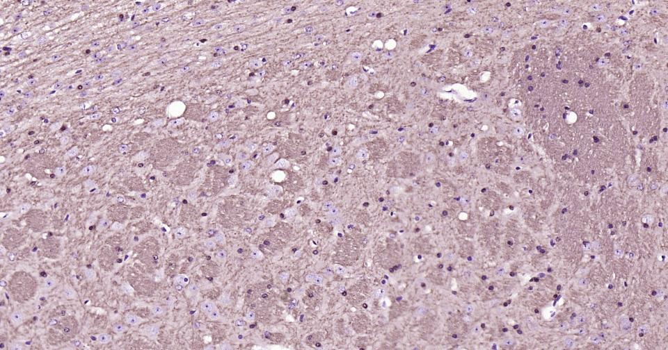 2’,3’-环腺苷酸-3’-磷酸二酯酶重组兔单抗-bsm-61411R