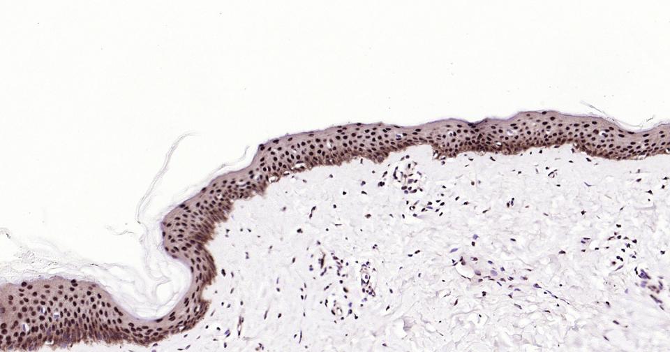 少突胶质细胞转录因子3重组兔单抗