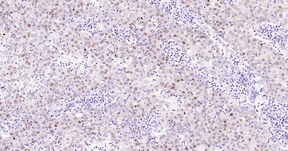 转录因子SOX9蛋白重组兔单抗