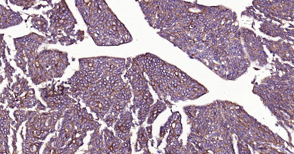 整合素αV（CD51）重组兔单抗