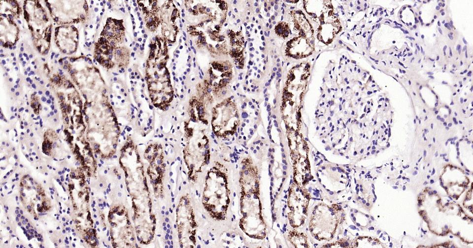 γ氨基丁酸转氨酶重组兔单抗