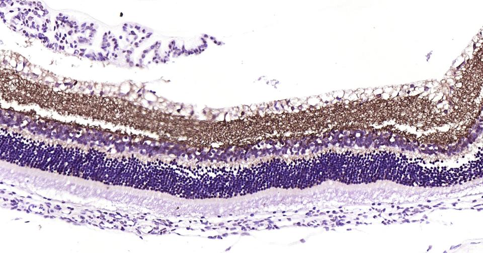 γ氨基丁酸运载蛋白1重组兔单抗