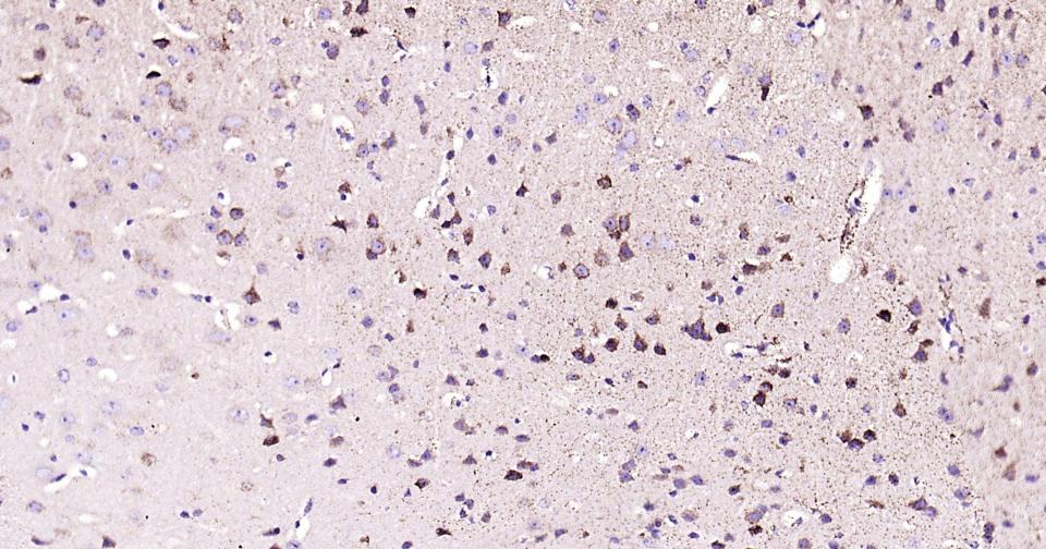 γ氨基丁酸转氨酶重组兔单抗